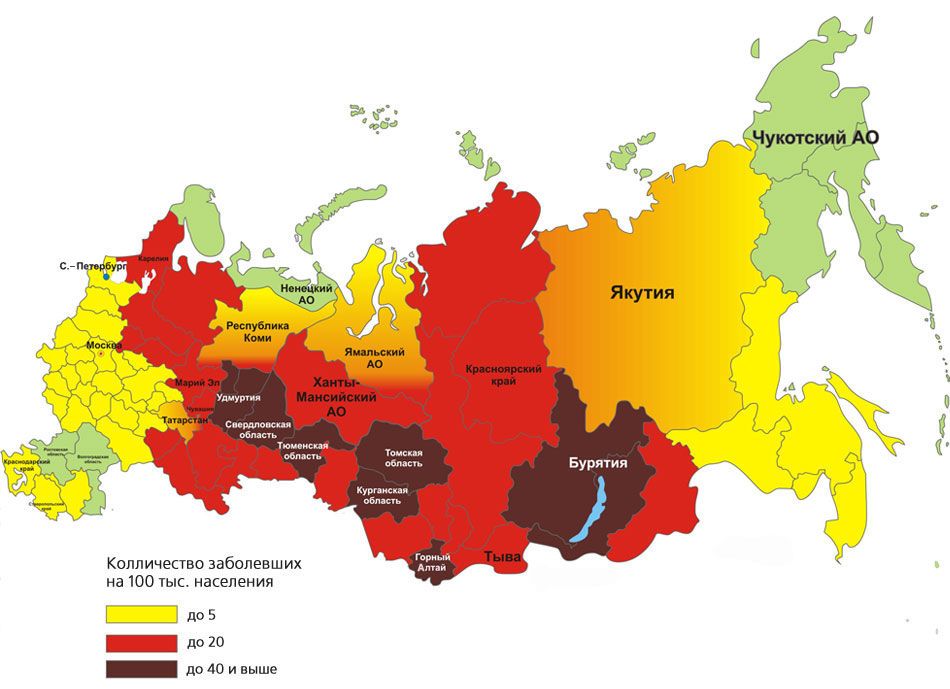 encefalit_areal.jpg encefalit_areal.jpg